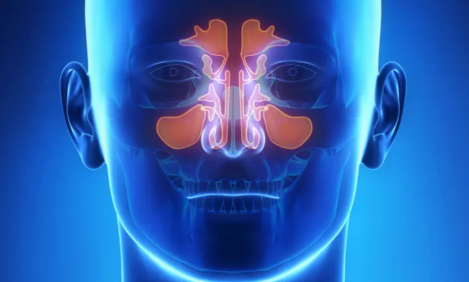 Sinus