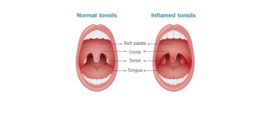 Throat