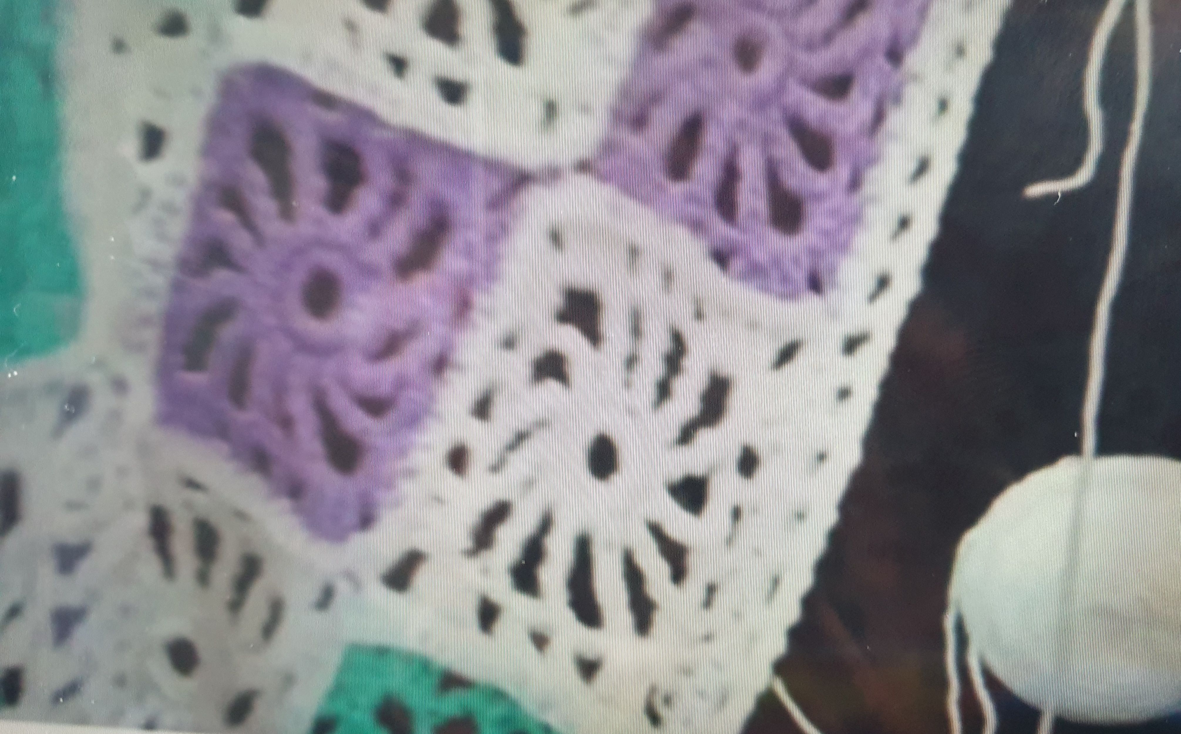 Knitting Tip 