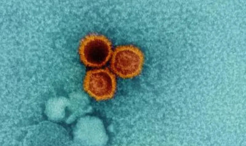 Severe COVID-19 Can Reactivate Dormant Viruses and Trigger Autoimmune Issues