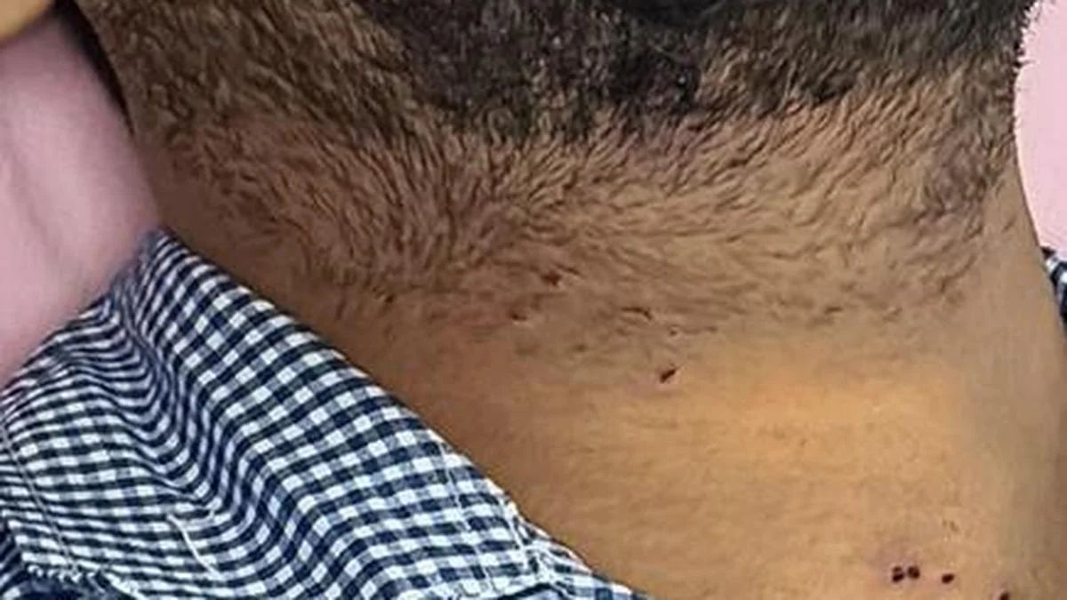 Supreme Court Probes Delhi Police Over Pellet Gun Use in Protests