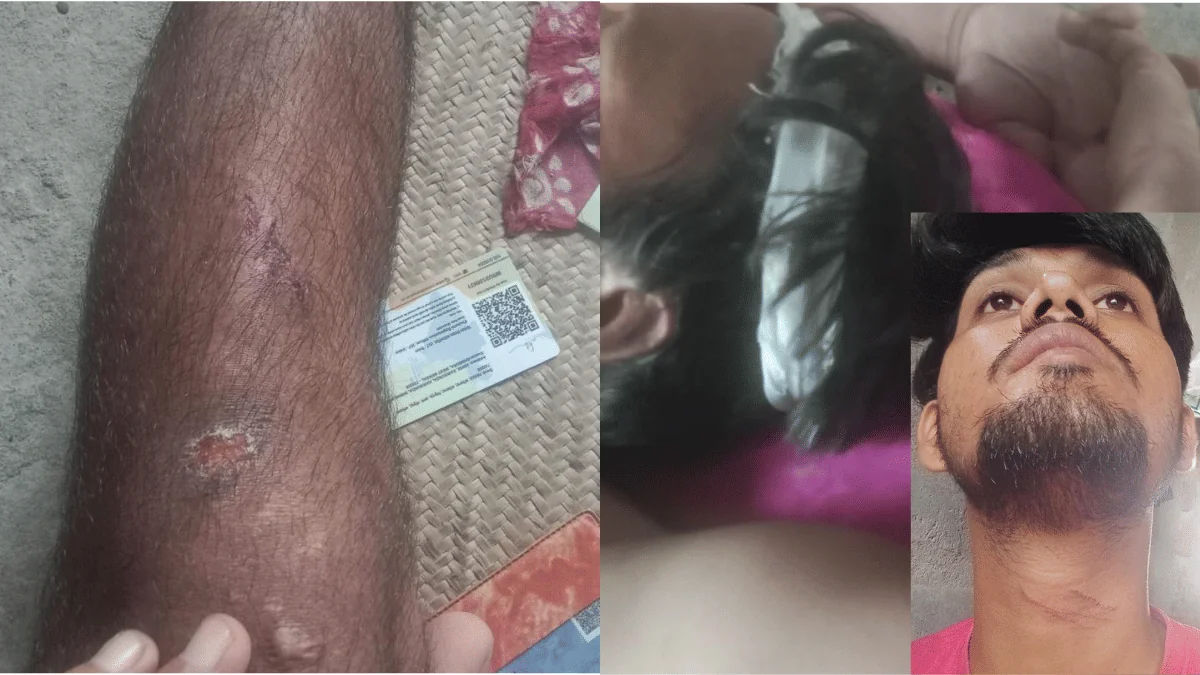 Fatal Attack on Activist's Father Follows West Bengal School Audit Campaign