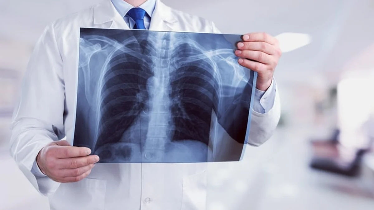 Global Tuberculosis Fight Stalls Despite Modest Case Decline