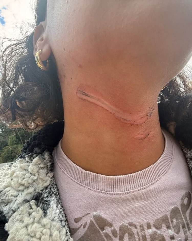 Tulum to intensify cable inspections after motorcyclists injured on Kukulcán Street - Photo 1 630412130_1214647137532453_3725867382822908502_n