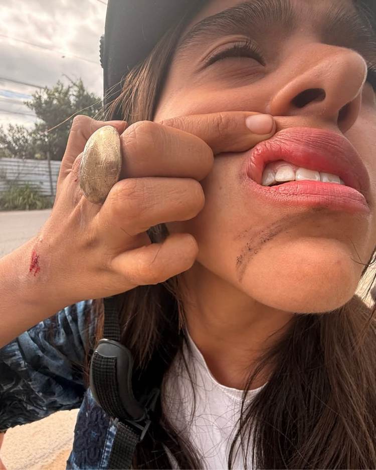 Tulum to intensify cable inspections after motorcyclists injured on Kukulcán Street - Photo 2 632017307_1214647140865786_5462395864769230065_n
