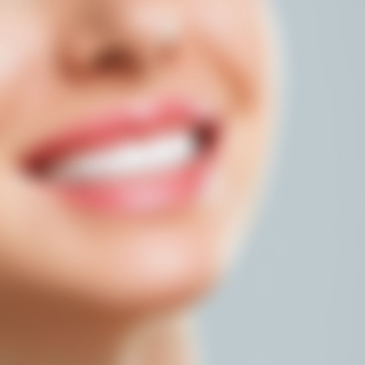 Teeth Whitening