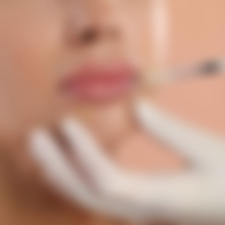 Fillers