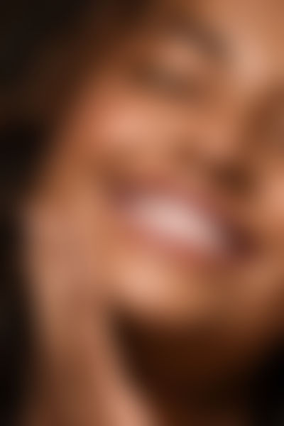 Teeth Whitening