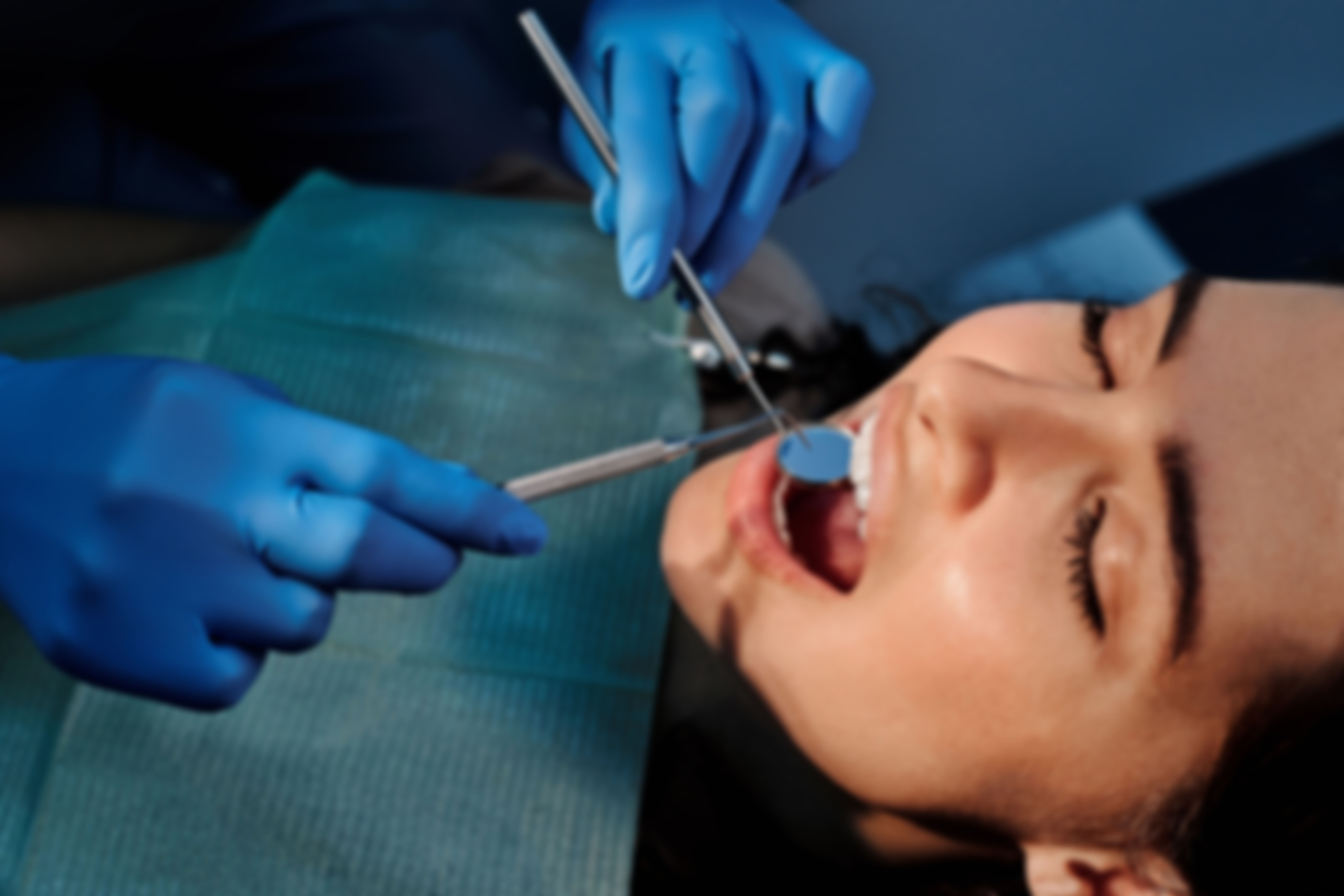 Teeth Whitening