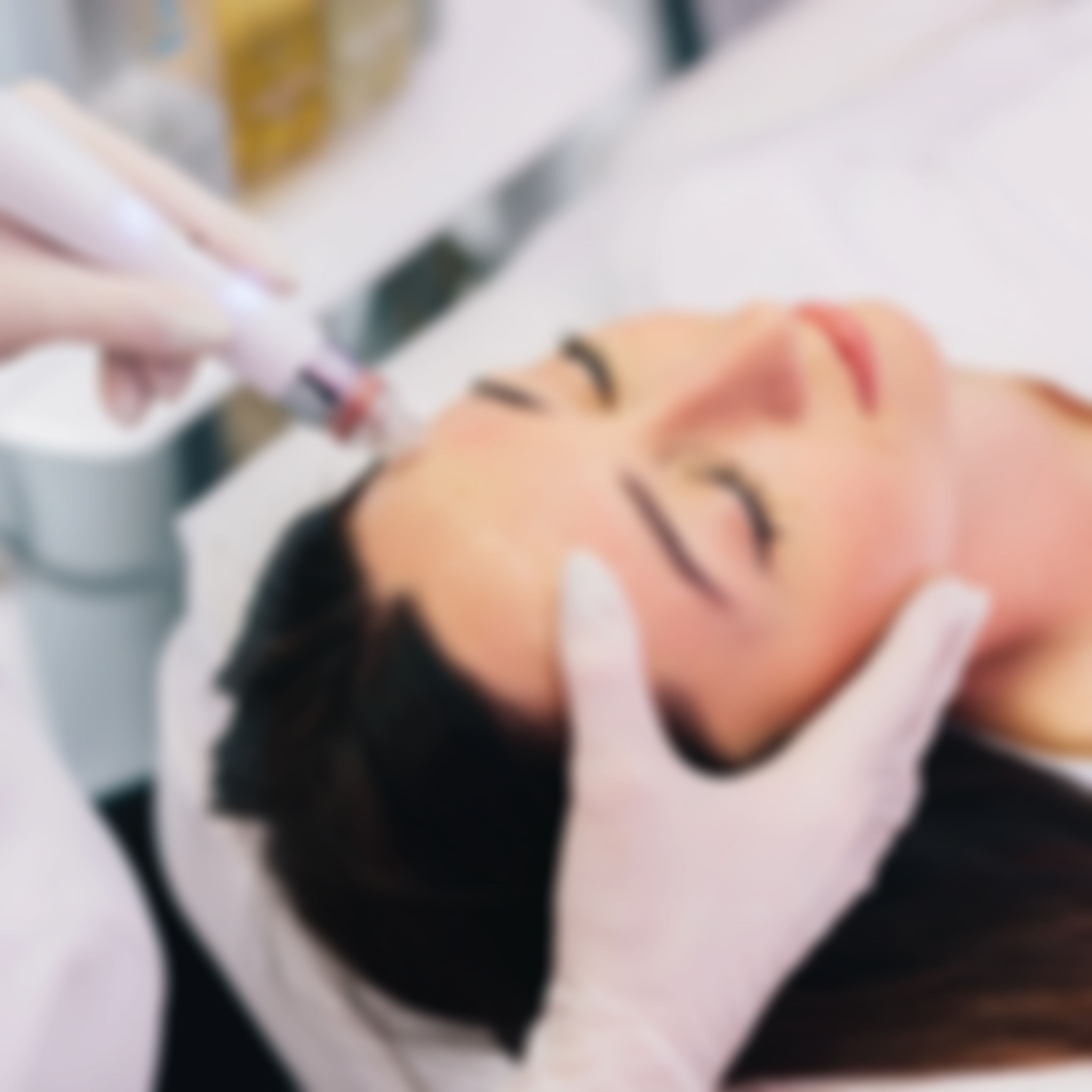 Microneedling