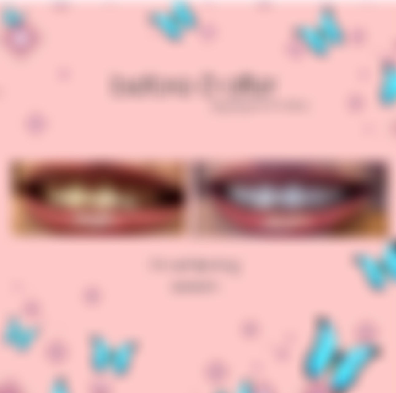 Teeth Whitening