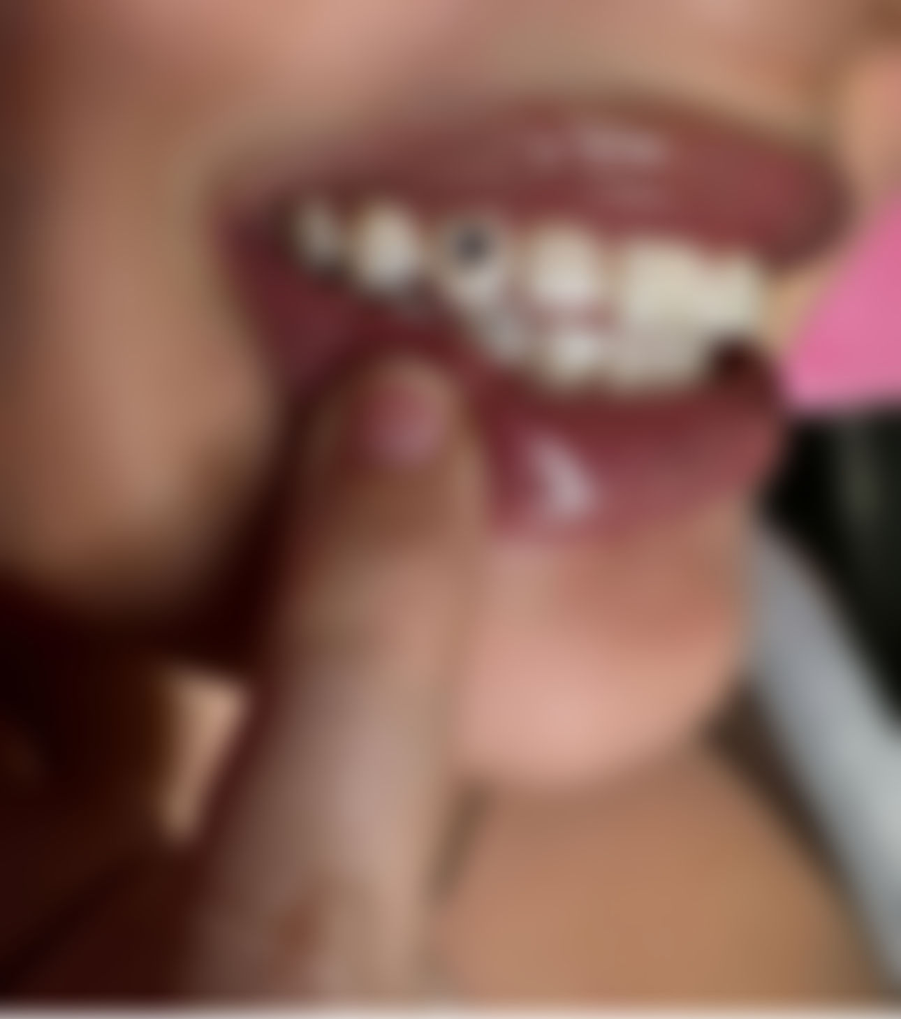 Tooth Gems