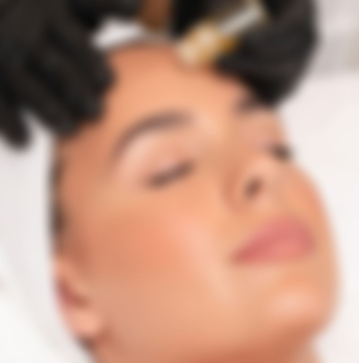 What is AquaGold Microneedling?