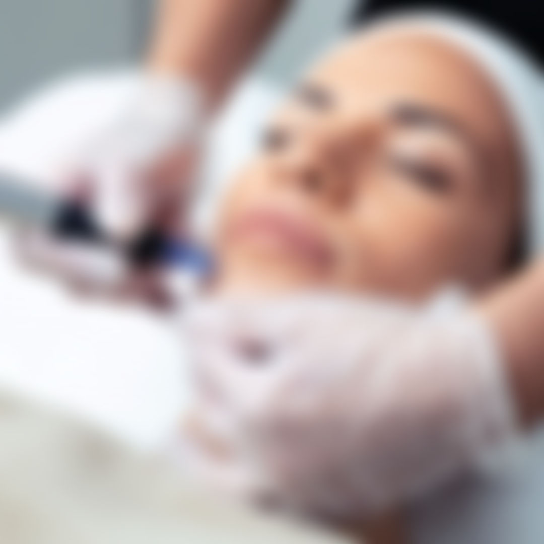 Collagen Induction Therapy