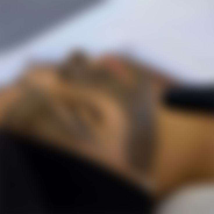 Laser Skin Treatment