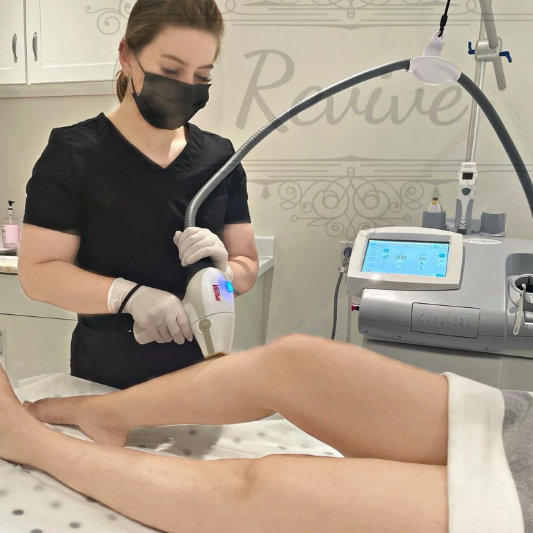 Brazilian Wax - Revive Beauty Solutions