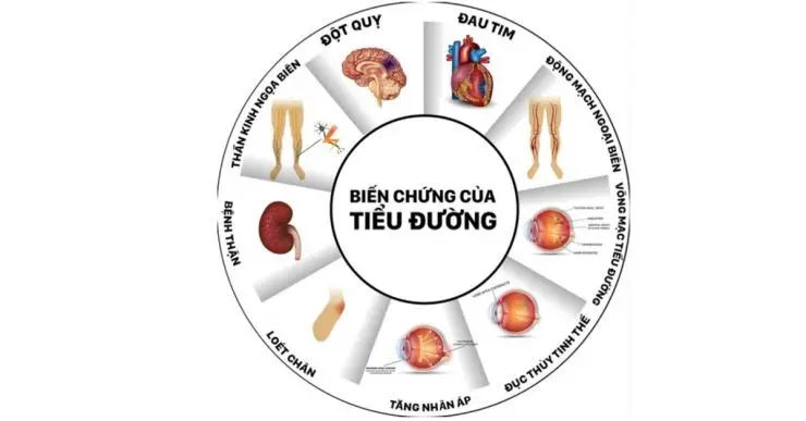 Cách Đo Đường Huyết Bằng Máy Để Phát Hiện Sớm Bệnh Tiểu Đường