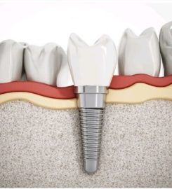Dental Smiles