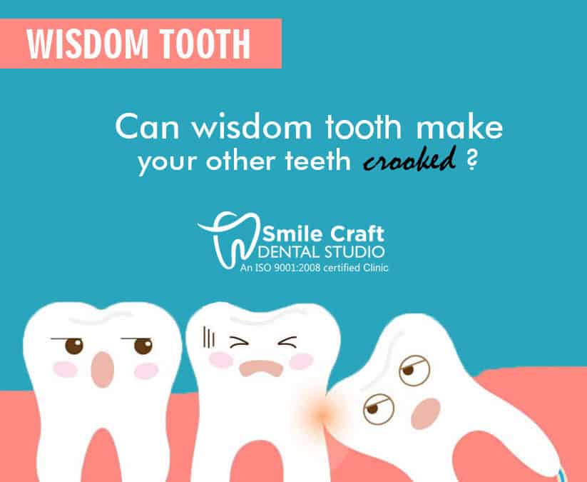 Dental Implants in Ahmedabad | Cosmetic Dentisry | Dentist in Ahmedabad – Smile Craft