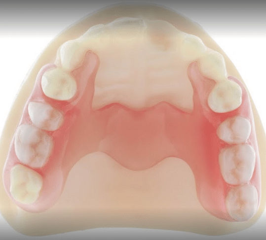 Parada Dentures Fergus