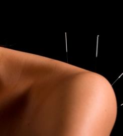 Giordano Acupuncture