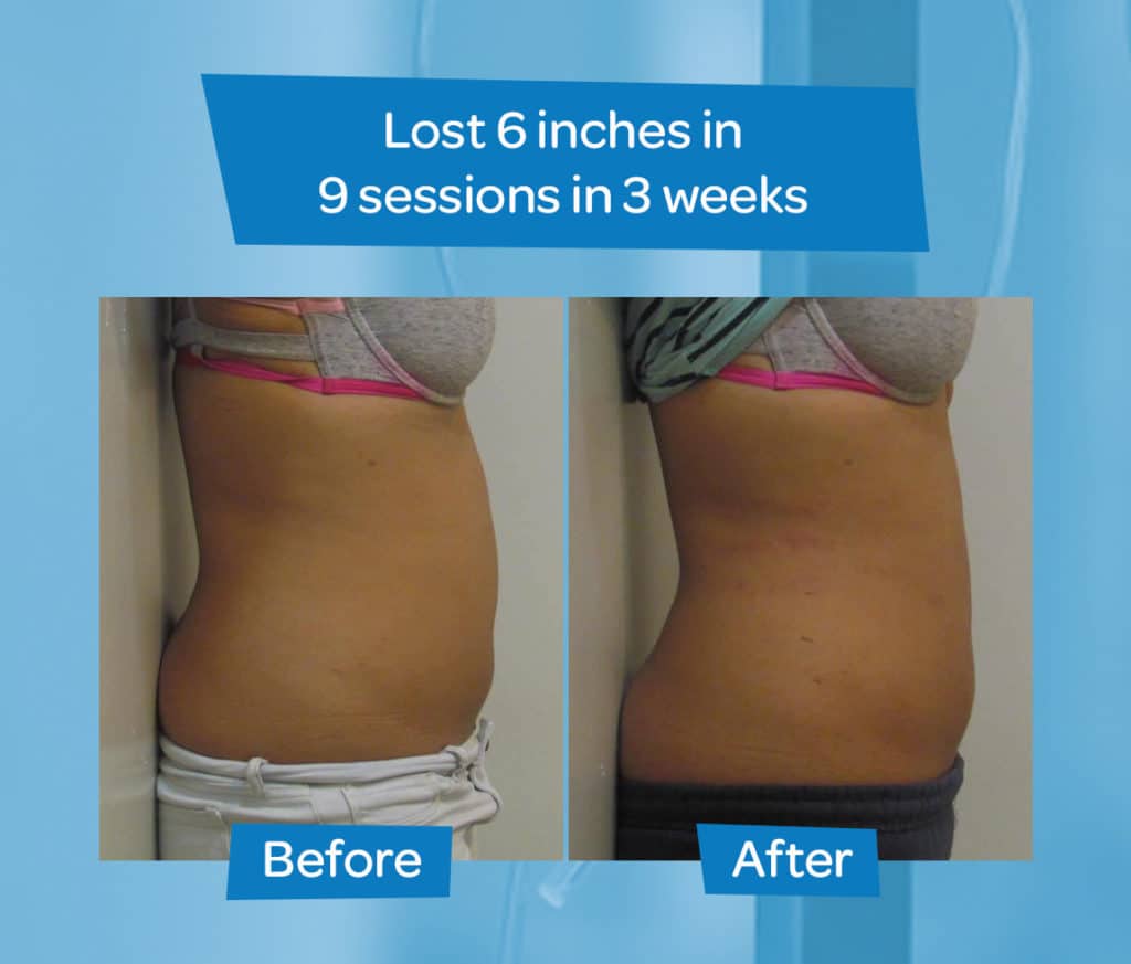 Dr. Tred’s Slim Body Laser Spa