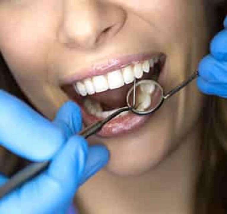 Teeth Implants Albany