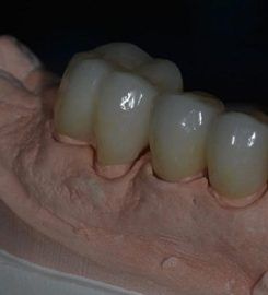 Affordable Private Dental Insurance