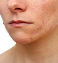 Manhattan Dermatology Specialists