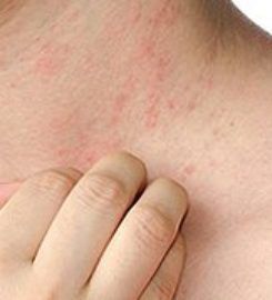 Manhattan Dermatology Specialists