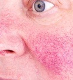 Manhattan Dermatology Specialists
