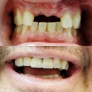 Dr. Lawrence Hung | Cosmetic Dentist Caledon