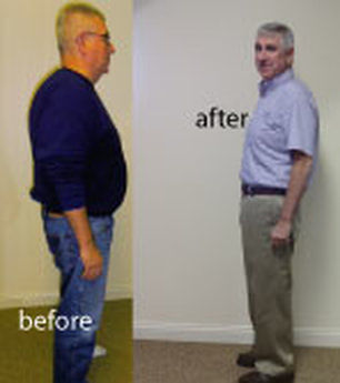 Homeopathic Hcg Indianapolis