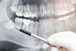 Hoboken Oral Surgeons, LLC