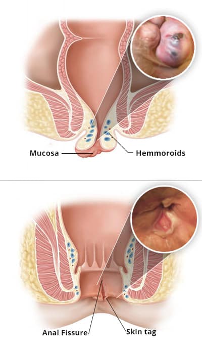 Colonoscopy and Endoscopy Center