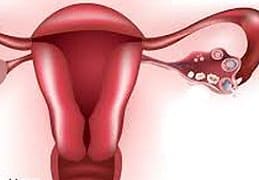 Gynecologist NYC – Anat Zelmanovich, M.D.
