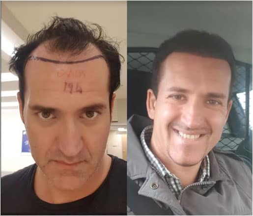 Capilclinic