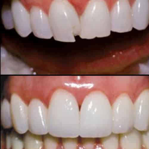 Cosmetic Dentist of East Flatbush