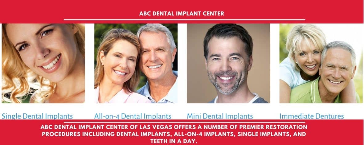 REMOVABLE DENTURES SERVICES IN LAS VEGAS