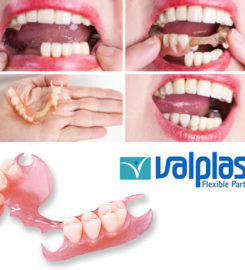 Affordable Dentures