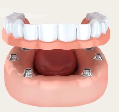 Brownstown Dental Care