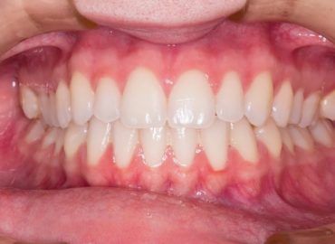 Complete Health Dentistry of NEPA