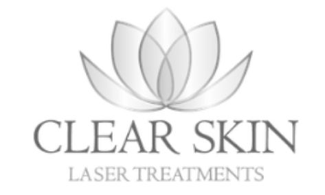 Clear skin laser treatments
