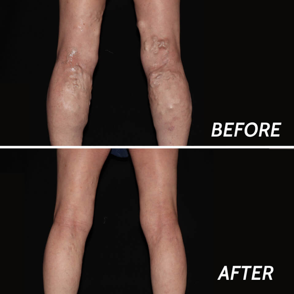 Vascular Surgeon Bergen County
