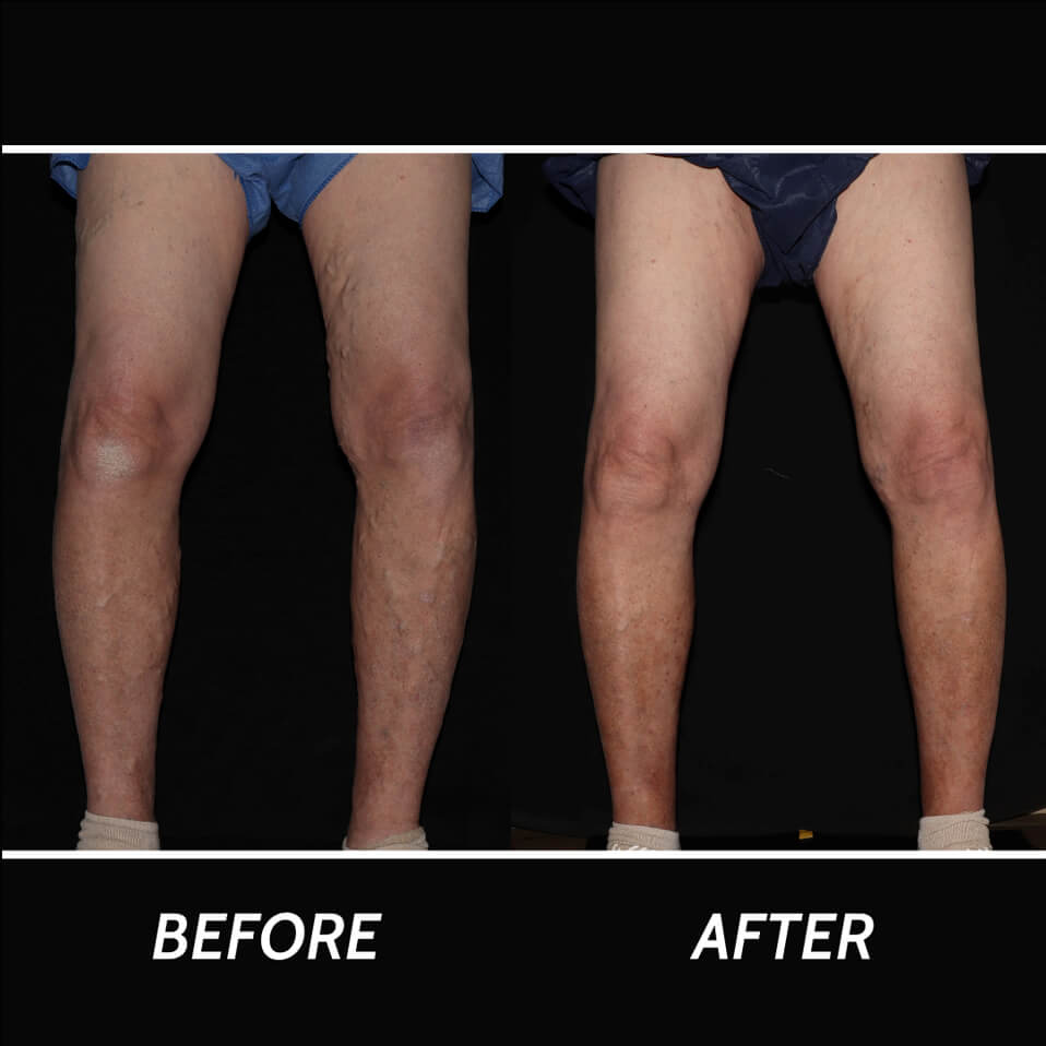 Vein Doctor Paramus