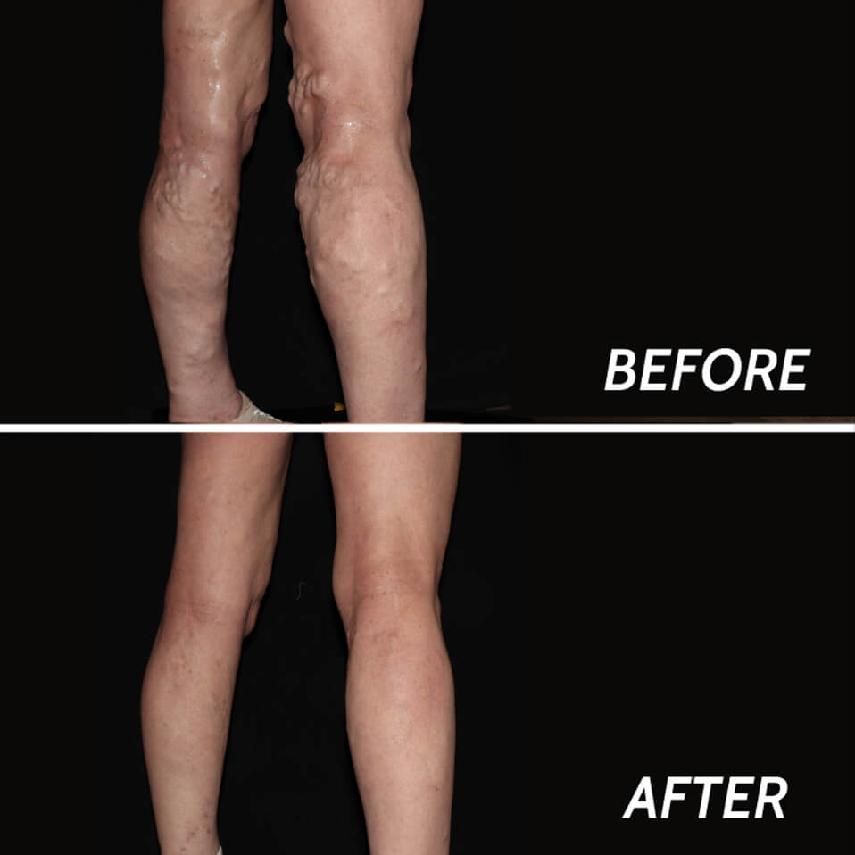 Weight Loss Treatments Bergen County