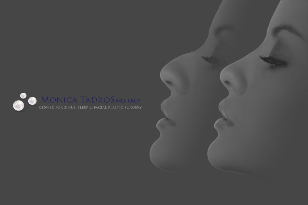Monica Tadros, MD, FACS