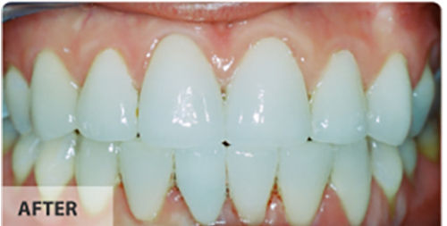 Family Dentist Bucks County