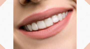 Dental Implants of Beverly Hills