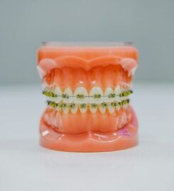 Zubní implantáty Brno